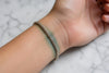 Does Sterling Silver Turn Skin Green? Causes & Fixes